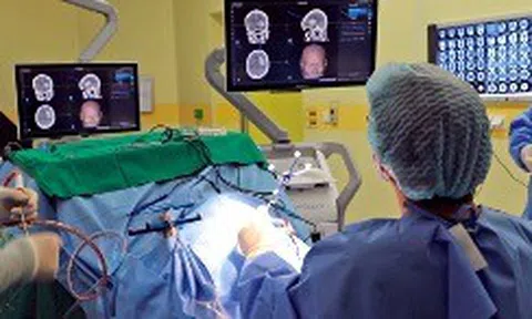 Cứu sống bệnh nhân đột quỵ bằng ứng dụng công nghệ định vị 3 chiều