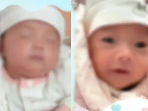 Hy hữu trường hợp hai bé song sinh chào đời cách nhau... 5 tuần